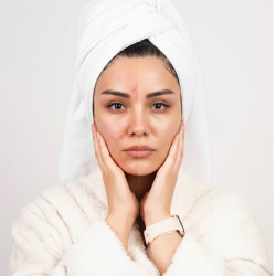 Well 10 Anti Acne Face Mask